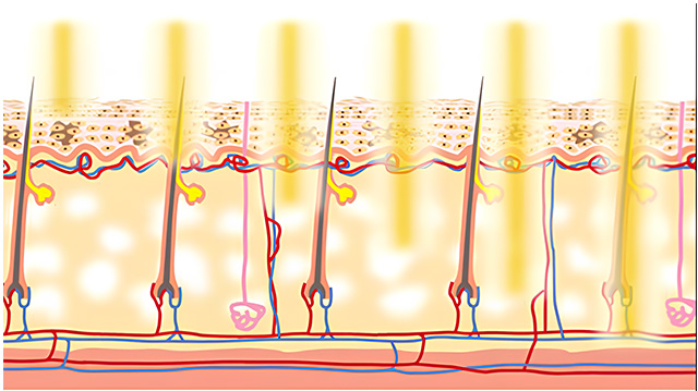 フォトフェイシャルのイメージ図