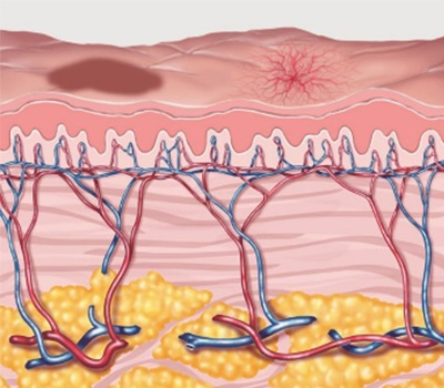 照射前イメージ図